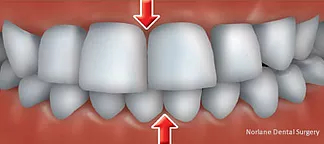 Orthodontics Consultation