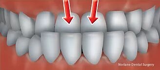 Orthodontics Consultation in norlane