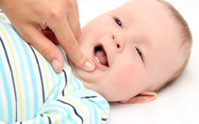 Preventing Cavities and Tooth Decay in Baby Teeth