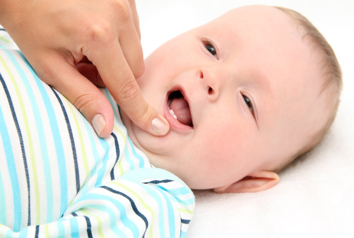 Featured image for “Preventing Cavities and Tooth Decay in Baby Teeth”