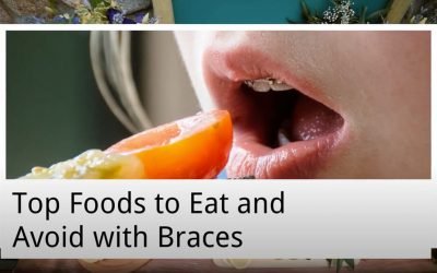Top Foods to Eat and Avoid with Braces from Norlane Dental Aesthetics and Implants