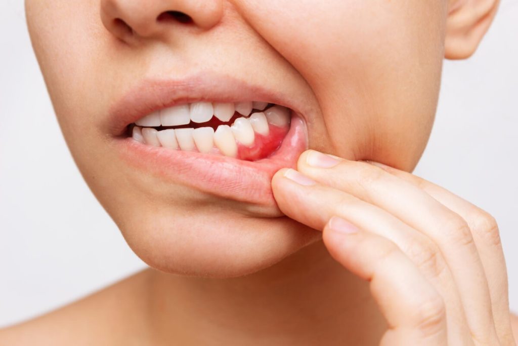 how gum disease poses a risk to overall health