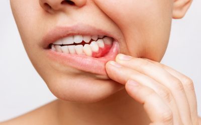 How Gum Disease Poses a Risk to Overall Health