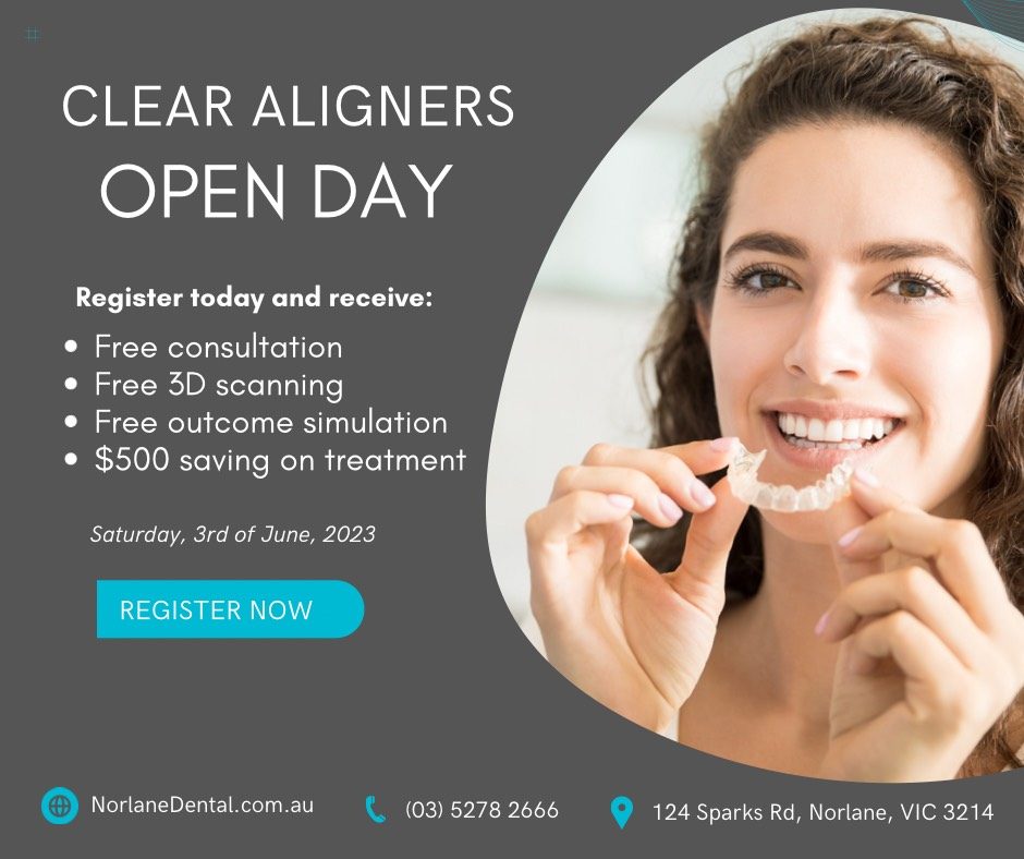 clear aligners open day full banner