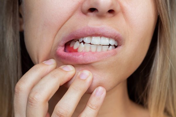 dental abscess norlane geelong