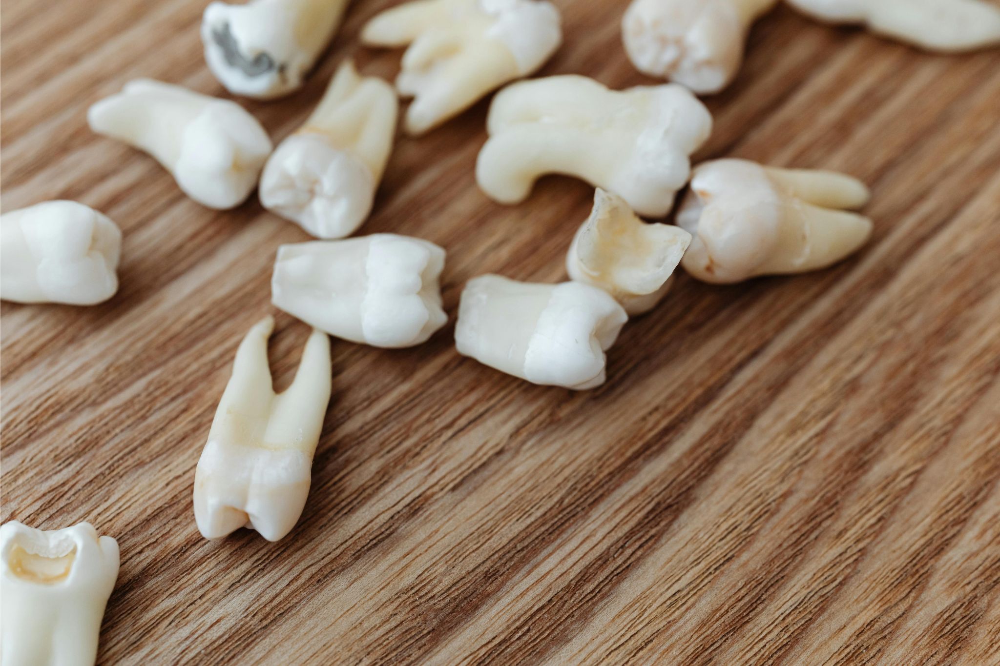 Featured image for “Dental Implants: A Permanent Solution for Missing Teeth”