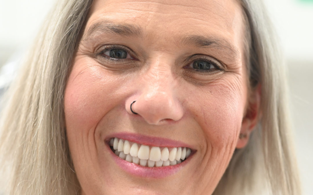 Patient smiling comfortably after overcoming dental anxiety with sleep dentistry at Norlane Dental in Geelong