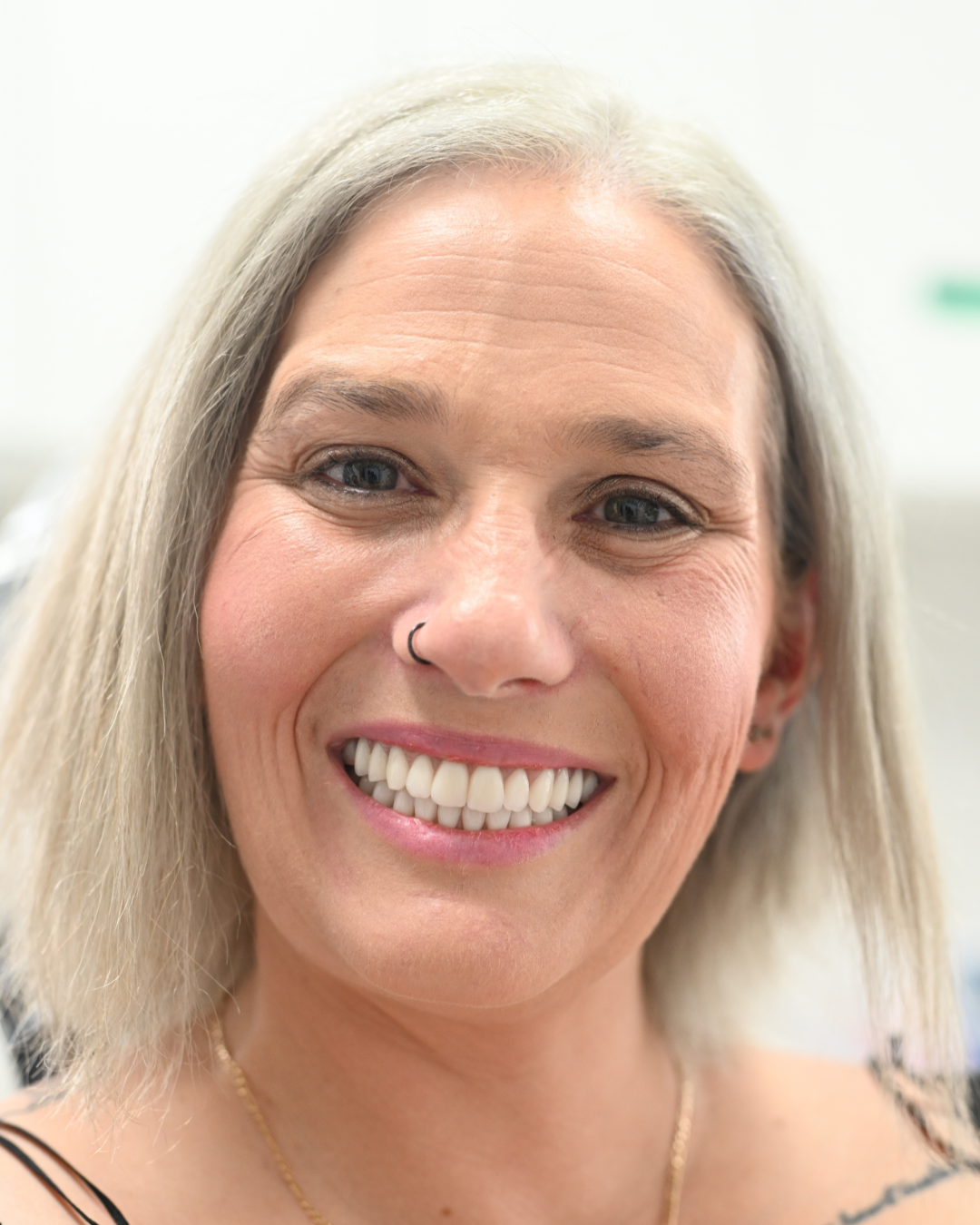 Featured image for “Barbara’s Dental Anxiety and Pain Relief Journey at Norlane Dental”