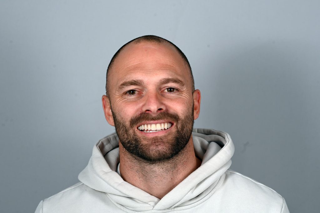 Ryan’s All-on-X dental implants before and after, image [1 of 7] – Norlane Dental Geelong