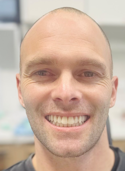 Featured image for “Kyle’s Confidence Transformation at Norlane Dental”