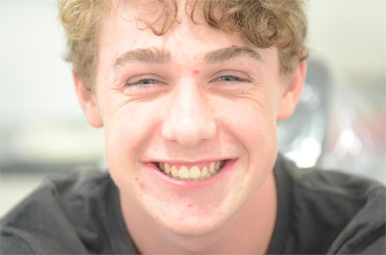 Featured image for “Early Orthodontic Treatment for Children | Braydon’s Smile Journey | Norlane Dental”