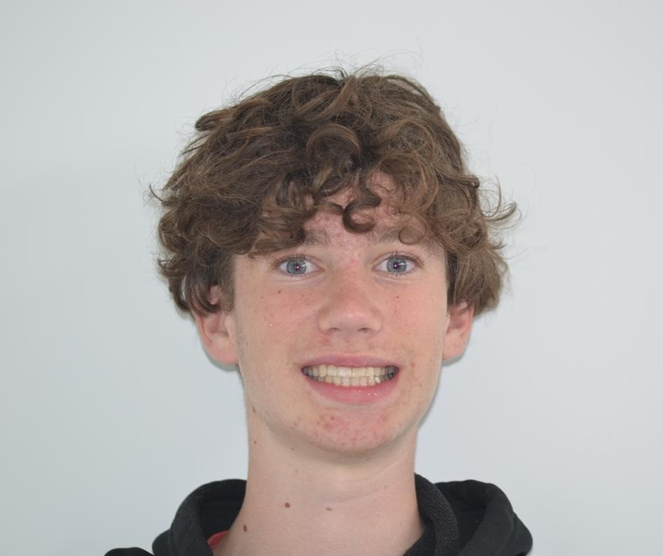 Featured image for “Orthodontic Treatment for Crowded Teeth & Crossbite | Archie’s Smile Journey”