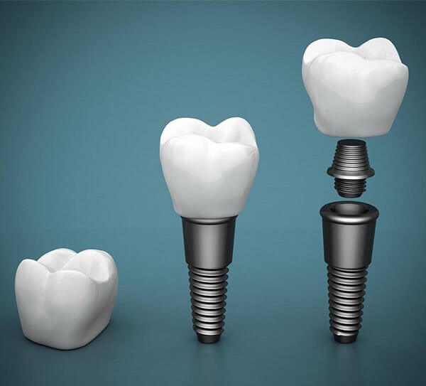 Norlane Dental