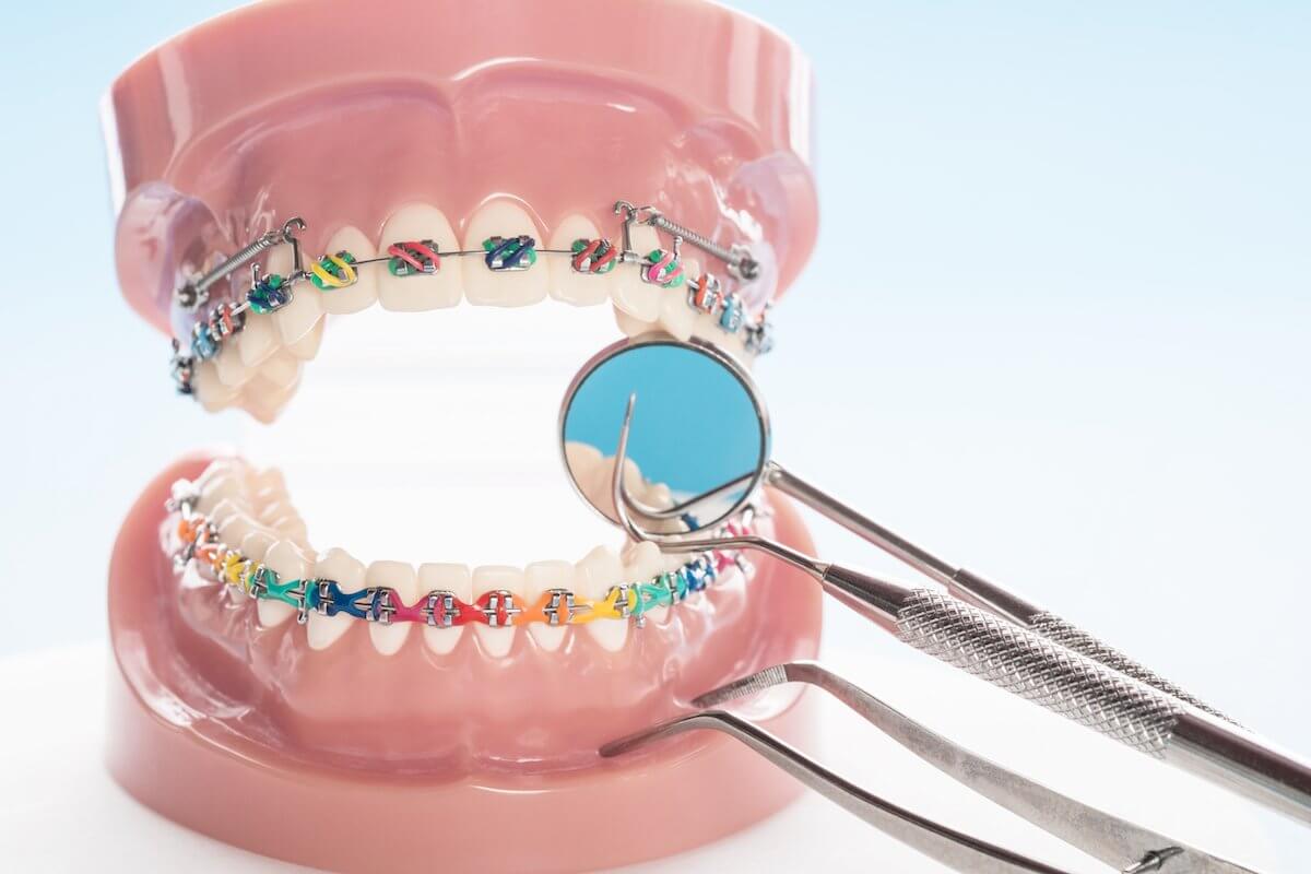 orthodontics norlane