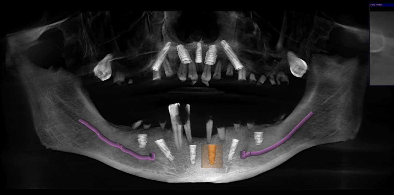 digital x-ray imaging